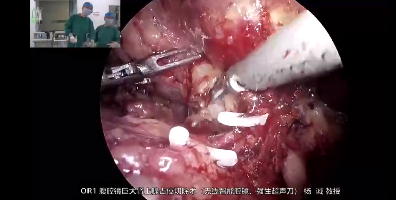 1662083015516229.png 12345.png